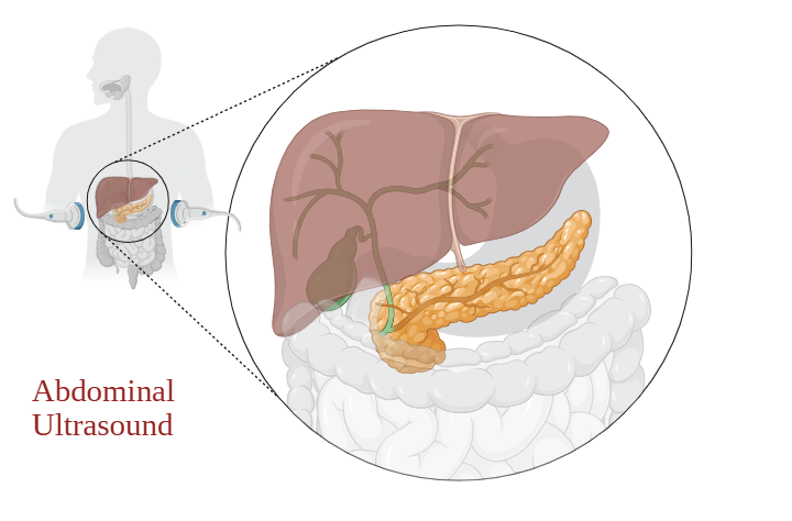Illustration of abdominal ultrasound anatomy.