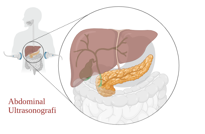 Abdominal ultrasound showing liver and pancreas