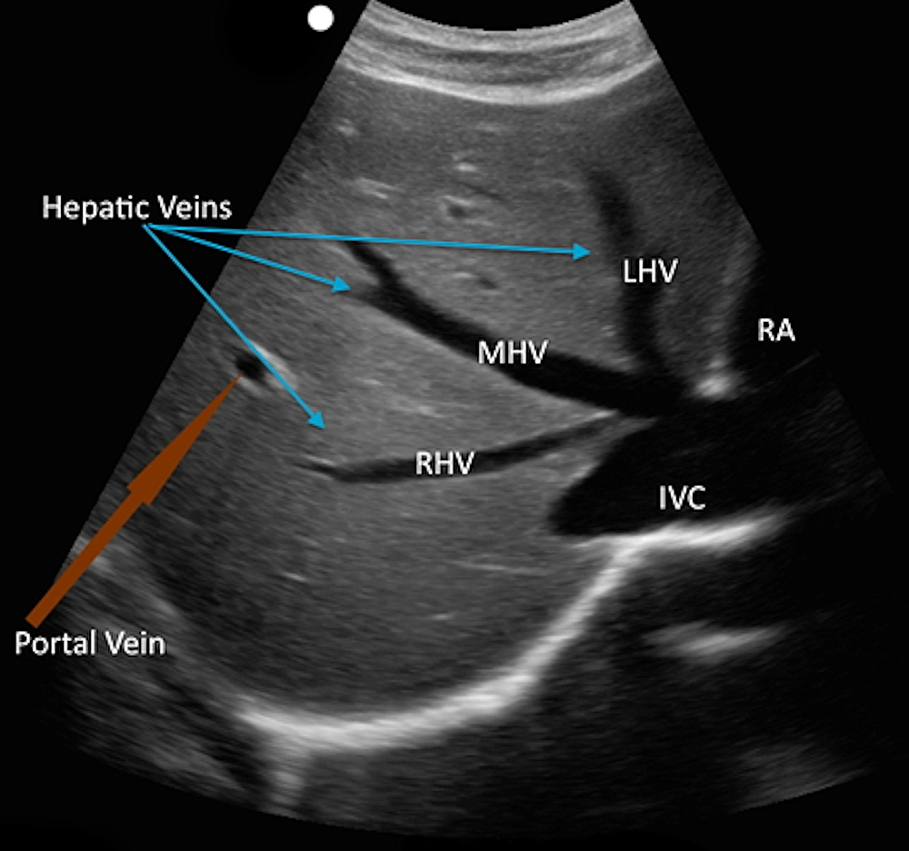 Abdominal Ultrasonografi